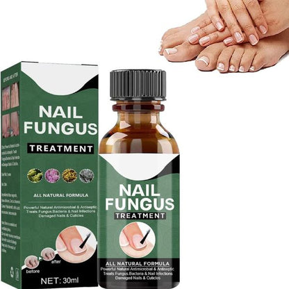 Proizvod PRODAVANI za negu noktiju prikazan na fotografiji.
